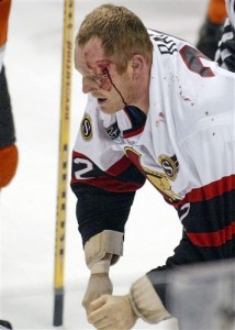 Bloodied Rob Ray after a fight with Donald Brashear. [photo: H. Rumph, Jr.]